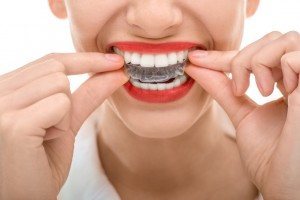 Female dental patient placing her affordable professional home teeth whitening tray